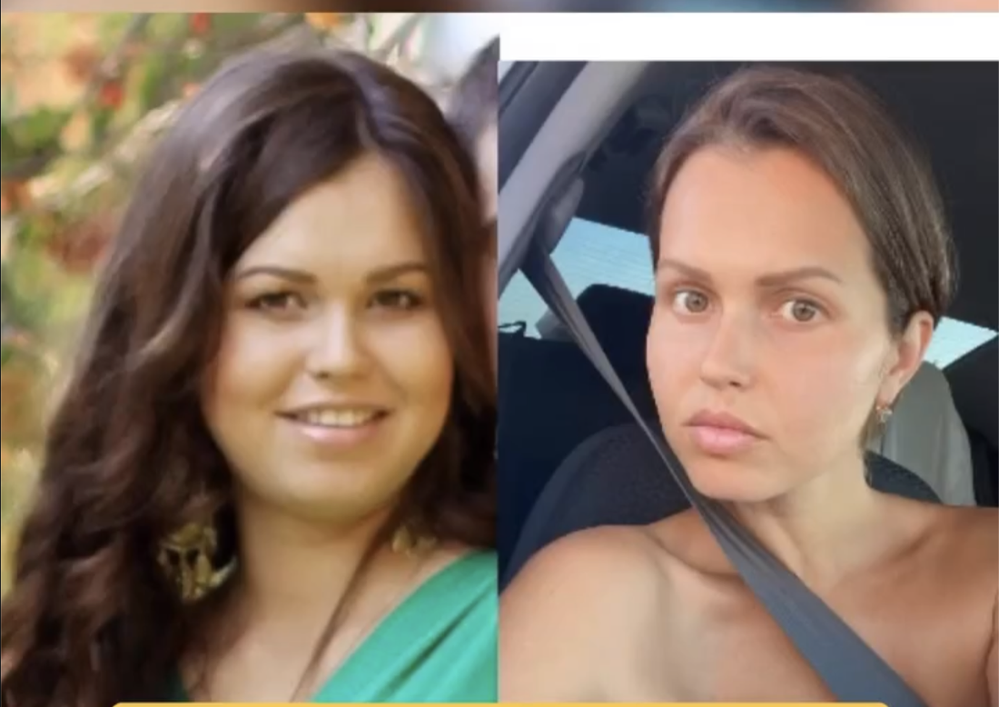 Альбина Галявина до и после очищения